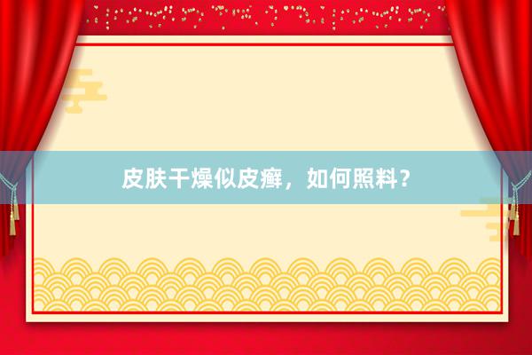 皮肤干燥似皮癣，如何照料？